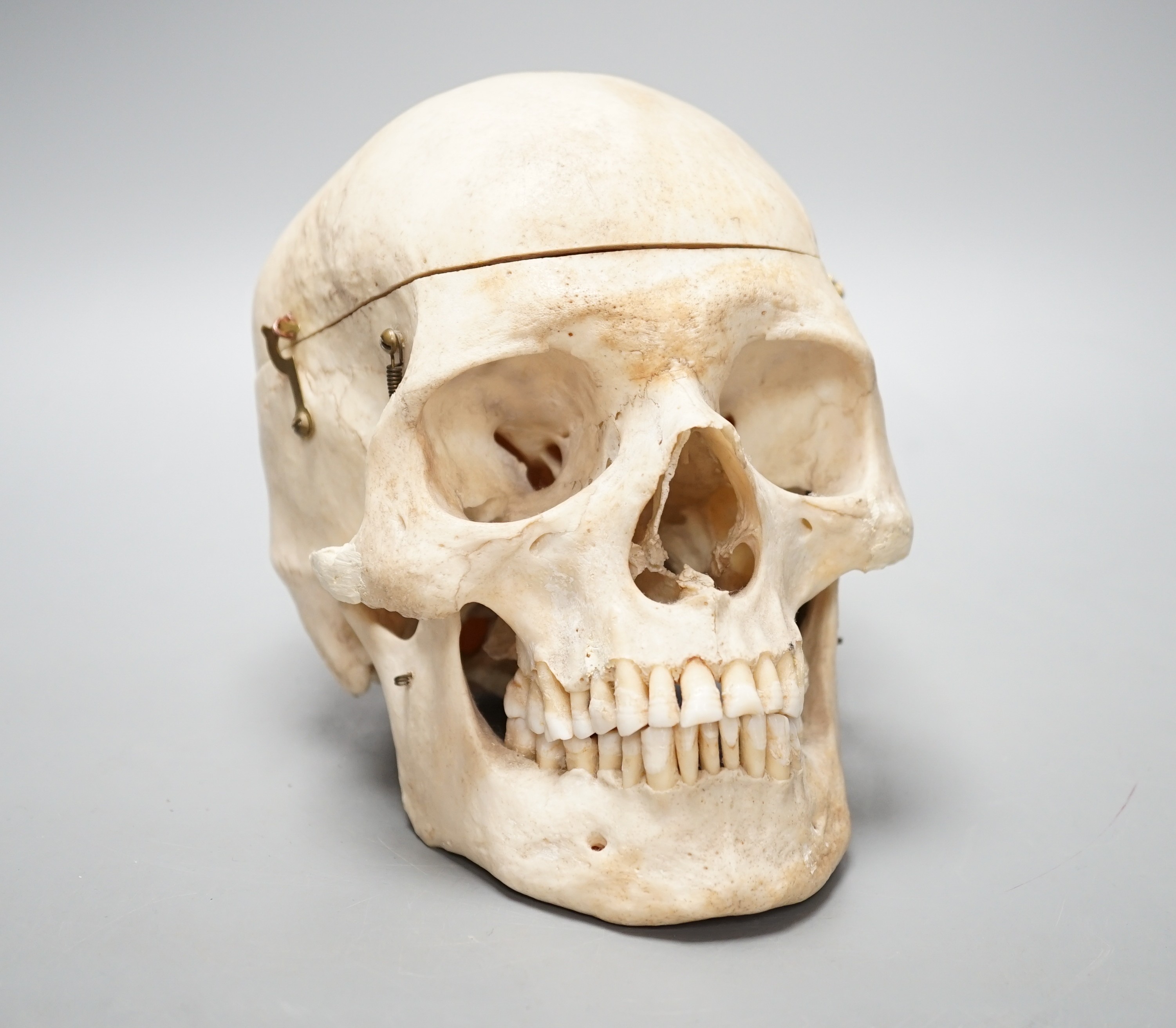 A human skull with removable cranium and spring loaded jaw 15.5cm
